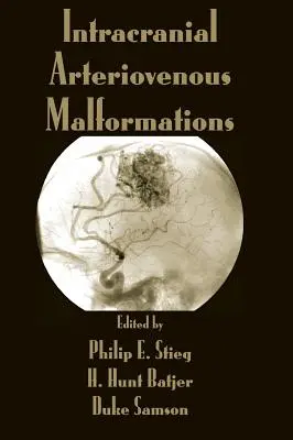 Intracranialis arteriovenosus malformációk - Intracranial Arteriovenous Malformations