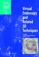 Virtuális endoszkópia és kapcsolódó 3D technikák - Virtual Endoscopy and Related 3D Techniques