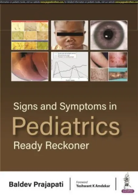 Jelek és tünetek a gyermekgyógyászatban - Ready Reckoner - Signs and Symptoms in Pediatrics - Ready Reckoner