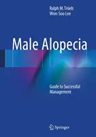 Férfi alopecia: Útmutató a sikeres kezeléshez - Male Alopecia: Guide to Successful Management