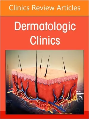 Diversity, Equity, and Inclusion in Dermatology, an Issue of Dermatologic Clinics: 41-2. kötet - Diversity, Equity, and Inclusion in Dermatology, an Issue of Dermatologic Clinics: Volume 41-2