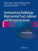 Genitourinary Radiology: Férfi genitális traktus, mellékvese és retroperitoneum: A kórtani alapok - Genitourinary Radiology: Male Genital Tract, Adrenal and Retroperitoneum: The Pathologic Basis