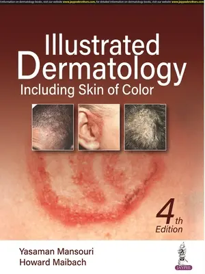 Illusztrált bőrgyógyászat - A színes bőrrel együtt - Illustrated Dermatology - Including Skin of Colour