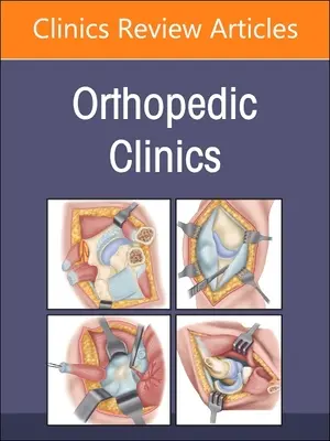 Technológiai előrelépések, az Ortopédiai Klinikák száma: 54-2. kötet - Technological Advances, an Issue of Orthopedic Clinics: Volume 54-2