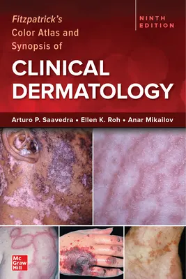 Fitzpatrick's Color Atlas and Synopsis of Clinical Dermatology, kilencedik kiadás - Fitzpatrick's Color Atlas and Synopsis of Clinical Dermatology, Ninth Edition