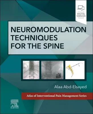 Neuromodulációs technikák a gerinc számára: Az Atlas of Interventional Pain Management sorozat egy kötete - Neuromodulation Techniques for the Spine: A Volume in the Atlas of Interventional Pain Management Series