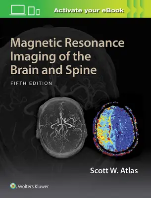 Az agy és a gerinc mágneses rezonanciás képalkotása - Magnetic Resonance Imaging of the Brain and Spine