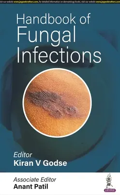 A gombás fertőzések kézikönyve - Handbook of Fungal Infections