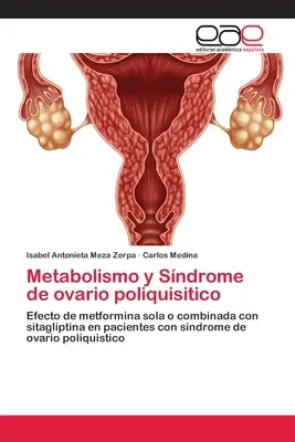 Metabolismo y Sndrome de ovario poliquisitico