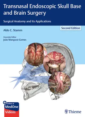 Transznazális endoszkópos koponyabázis- és agysebészet: Sebészeti anatómia és alkalmazásai - Transnasal Endoscopic Skull Base and Brain Surgery: Surgical Anatomy and Its Applications