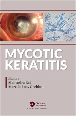 Mycoticus keratitis - Mycotic Keratitis