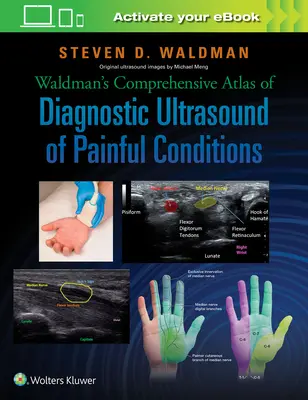 Waldman átfogó atlasza a fájdalmas állapotok diagnosztikai ultrahangjáról - Waldman's Comprehensive Atlas of Diagnostic Ultrasound of Painful Conditions