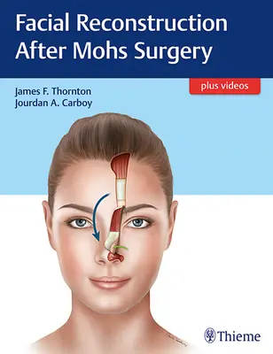 Arc rekonstrukció Mohs-műtét után - Facial Reconstruction After Mohs Surgery