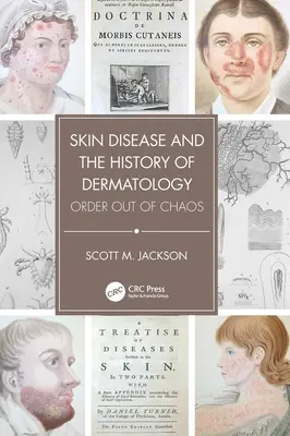 Bőrbetegségek és a bőrgyógyászat története: Rend a káoszból - Skin Disease and the History of Dermatology: Order Out of Chaos