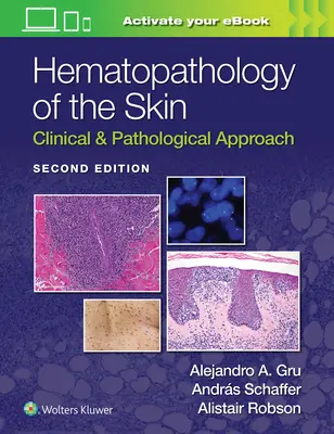 A bőr hematopatológiája: Klinikai és patológiai megközelítés - Hematopathology of the Skin: Clinical & Pathological Approach