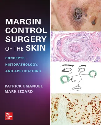 Margin Control Surgery of the Skin: Fogalmak, szövettan és alkalmazások - Margin Control Surgery of the Skin: Concepts, Histopathology, and Applications