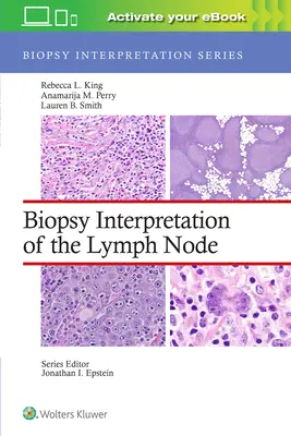 A nyirokcsomó biopsziás értelmezése - Biopsy Interpretation of the Lymph Node