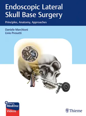 Endoszkópos oldalsó koponyaalapi sebészet: Elvek, anatómia, megközelítések - Endoscopic Lateral Skull Base Surgery: Principles, Anatomy, Approaches