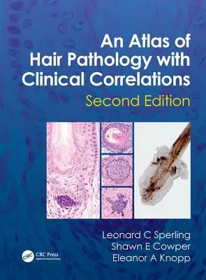 A hajpatológia atlasza klinikai összefüggésekkel - An Atlas of Hair Pathology with Clinical Correlations