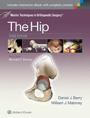 Az ortopédiai sebészet mesterműszerei: A csípő - Master Techniques in Orthopaedic Surgery: The Hip