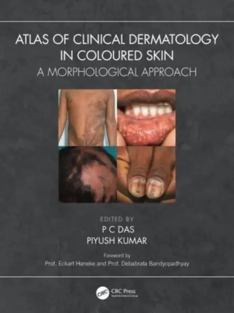 A klinikai bőrgyógyászat atlasza a színes bőrben: Morfológiai megközelítés - Atlas of Clinical Dermatology in Coloured Skin: A Morphological Approach