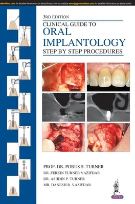 Klinikai útmutató az orális implantológiához: Lépésről lépésre az eljárások - Clinical Guide to Oral Implantology: Step by Step Procedures