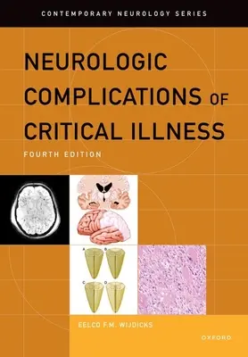 A kritikus betegség neurológiai szövődményei - Neurologic Complications of Critical Illness