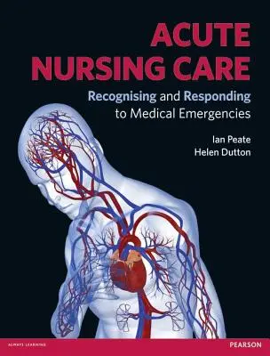 Akut ápolás: Vészhelyzetek felismerése és az azokra való reagálás - Acute Nursing Care: Recognising and Responding to Medical Emergencies