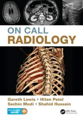 Radiológiai ügyelet - On Call Radiology