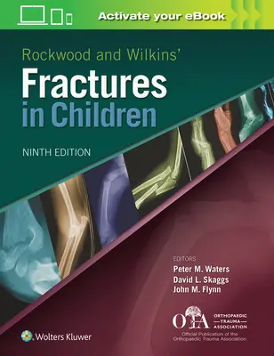 Rockwood és Wilkins Gyermekkori törések - Rockwood and Wilkins Fractures in Children