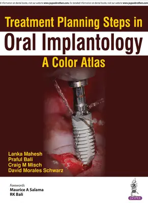 A kezelés tervezésének lépései az orális implantológiában: Színes atlasz - Treatment Planning Steps in Oral Implantology: A Color Atlas