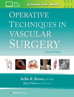 Operatív technikák az érsebészetben - Operative Techniques in Vascular Surgery