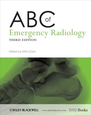 A sürgősségi radiológia ABC-je - ABC of Emergency Radiology