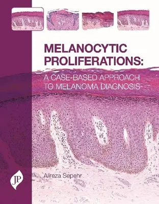 Melanocytás proliferációk - Esetalapú megközelítés a melanoma diagnózisához - Melanocytic Proliferations - A Case-Based Approach to Melanoma Diagnosis