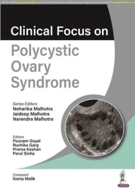 Klinikai fókuszban a policisztás ovárium szindróma - Clinical Focus on Polycystic Ovary Syndrome