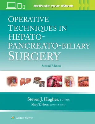 Operatív technikák a hepato-pankreato-biliáris sebészetben - Operative Techniques in Hepato-Pancreato-Biliary Surgery