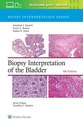 A hólyag biopsziás értelmezése - Biopsy Interpretation of the Bladder