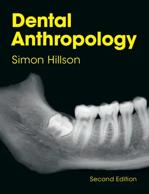 Fogászati antropológia (Hillson Simon (University College London)) - Dental Anthropology (Hillson Simon (University College London))