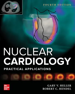 Nukleáris kardiológia: Gyakorlati alkalmazások, negyedik kiadás - Nuclear Cardiology: Practical Applications, Fourth Edition