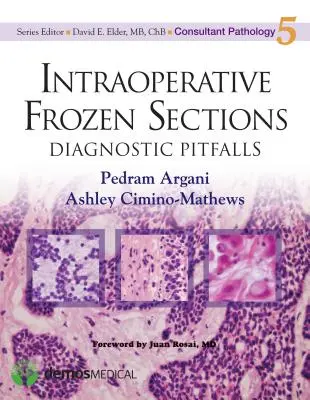 Intraoperatív fagyasztott metszetek: Diagnosztikai buktatók - Intraoperative Frozen Sections: Diagnostic Pitfalls