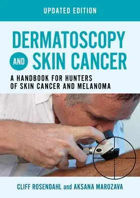 Dermatoszkópia és bőrrák, frissített kiadás - Kézikönyv a bőrrák és a melanoma vadászai számára - Dermatoscopy and Skin Cancer, updated edition - A handbook for hunters of skin cancer and melanoma