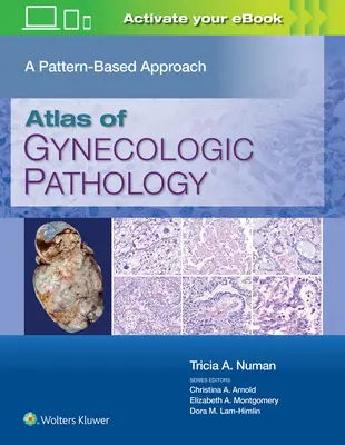 A nőgyógyászati patológia atlasza: A Pattern-Based Approach - Atlas of Gynecologic Pathology: A Pattern-Based Approach