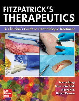 Fitzpatrick terápiája: A Clinician's Guide to Dermatologic Treatment (A klinikus útmutatója a bőrgyógyászati kezeléshez) - Fitzpatrick's Therapeutics: A Clinician's Guide to Dermatologic Treatment