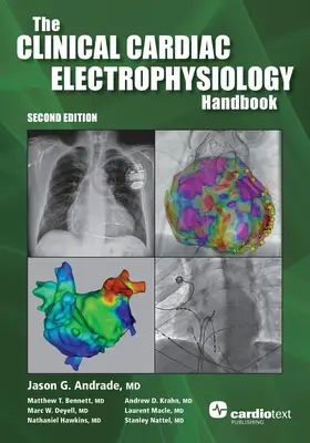 A klinikai szívelektrofiziológia kézikönyve, második kiadás - The Clinical Cardiac Electrophysiology Handbook, Second Edition