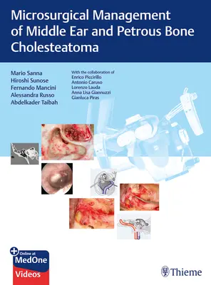 A középfül és a köldökcsont cholesteatomájának mikrosebészeti kezelése - Microsurgical Management of Middle Ear and Petrous Bone Cholesteatoma