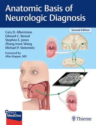 A neurológiai diagnózis anatómiai alapjai - Anatomic Basis of Neurologic Diagnosis