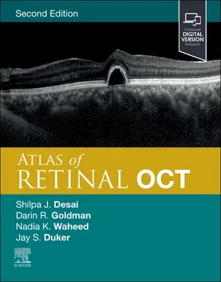 Atlas of Retinal Oct: Optikai koherencia tomográfia - Atlas of Retinal Oct: Optical Coherence Tomography