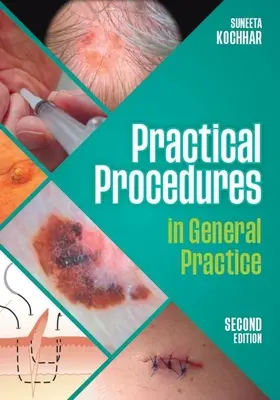 Gyakorlati eljárások az általános gyakorlatban, második kiadás (Kochhar Suneeta (GP in East Sussex)) - Practical Procedures in General Practice, second edition (Kochhar Suneeta (GP in East Sussex))