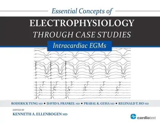 Az elektrofiziológia alapvető fogalmai esettanulmányokon keresztül: Intrakardiális EGM-ek: Intrakardiális EGM-ek - Essential Concepts of Electrophysiology Through Case Studies: Intracardiac EGMs: Intracardiac EGMs