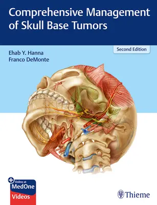 A koponyaalapi daganatok átfogó kezelése - Comprehensive Management of Skull Base Tumors